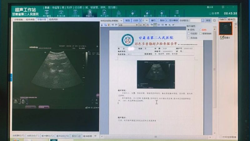 孕前体检血常规参数对照，了解这些指标至关重要